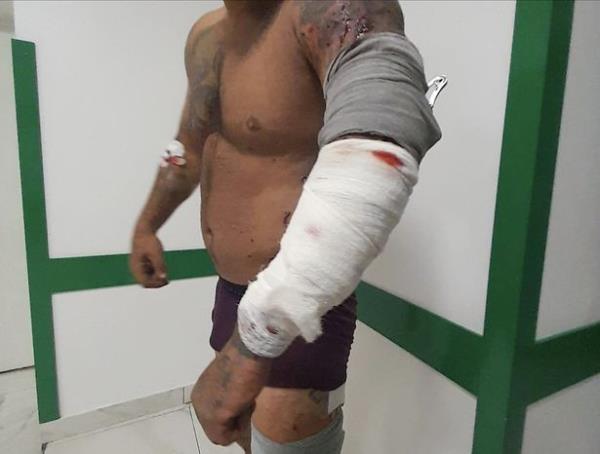 Adam's arm was also injured in the blast