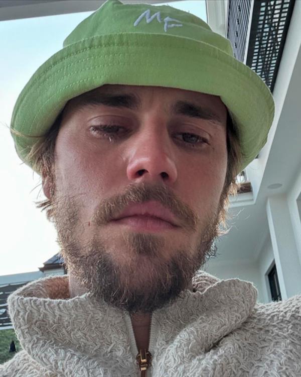 Justin Bieber Posts Photo In Tears, Sparking Co<em></em>ncern From Fans