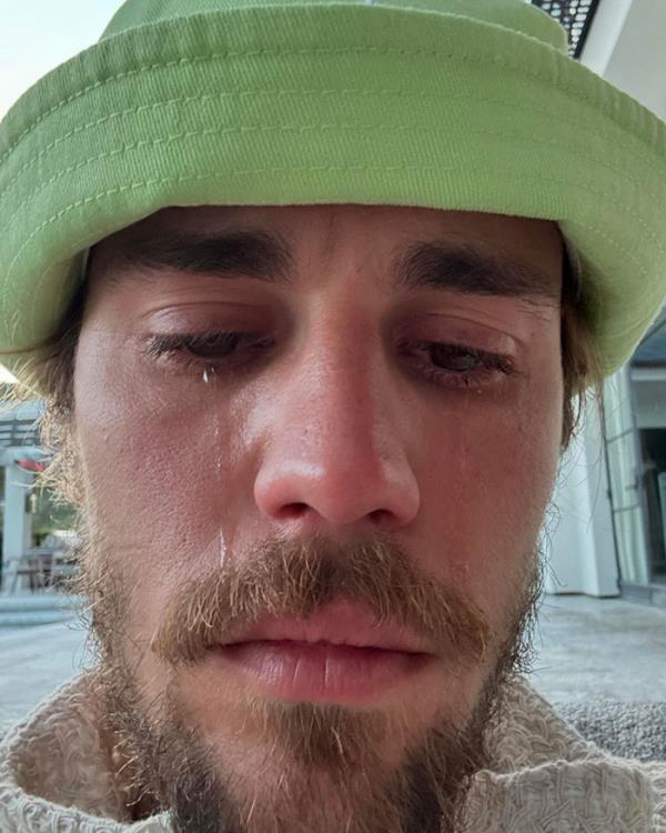 Justin Bieber Posts Photo In Tears, Sparking Co<em></em>ncern From Fans
