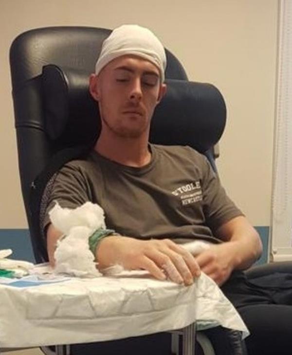 PIC FROM Kennedy News and Media (PIC SHOWS: SCOTT BASS, 29, WAS HACKED IN THE HEAD BY HIS OWN STEPDAD WITH A MACHETE) A lad thought he was going to bleed to death after his own STEPDAD hacked him in the head with a MACHETE in a row over who inherits his mum's house - despite her still being alive. Legal co<em></em>nsultant Scott Bass was left with severe injuries including Zorro's giant 'Z' diced in his arm after he was slashed repeatedly with a 15-inch Gurkha-style military blade by his stepdad Mark Kilpatrick in January last year. The 29-year-old remains angry that his stepdad has reportedly not said sorry since the event but says he takes satisfaction in thinking of him sat in a prison cell while he goes on holiday. Scott, who lives in Darlington, Durham, needed seven staples in his head, had slices in his arm and could see the bone in his thumb wher<em></em>e Kilpatrick had struck him with the blade. DISCLAIMER: While Kennedy News and Media uses its best endeavours to establish the copyright and authenticity of all pictures supplied, it accepts no liability for any damage, loss or legal action caused by the use of images supplied and the publication of images is solely at your discretion. SEE KENNEDY NEWS COPY - 0161 697 4266