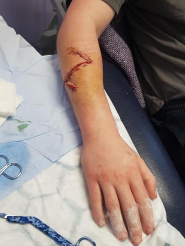 PIC FROM Kennedy News and Media (PIC SHOWS: SCOTT BASS, 29, WAS LEFT WITH SERIOUS INJURIES AFTER HE WAS ATTACKED BY A MACHETE) A lad thought he was going to bleed to death after his own STEPDAD hacked him in the head with a MACHETE in a row over who inherits his mum's house - despite her still being alive. Legal co<em></em>nsultant Scott Bass was left with severe injuries including Zorro's giant 'Z' diced in his arm after he was slashed repeatedly with a 15-inch Gurkha-style military blade by his stepdad Mark Kilpatrick in January last year. The 29-year-old remains angry that his stepdad has reportedly not said sorry since the event but says he takes satisfaction in thinking of him sat in a prison cell while he goes on holiday. Scott, who lives in Darlington, Durham, needed seven staples in his head, had slices in his arm and could see the bone in his thumb wher<em></em>e Kilpatrick had struck him with the blade. DISCLAIMER: While Kennedy News and Media uses its best endeavours to establish the copyright and authenticity of all pictures supplied, it accepts no liability for any damage, loss or legal action caused by the use of images supplied and the publication of images is solely at your discretion. SEE KENNEDY NEWS COPY - 0161 697 4266