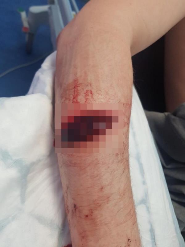 PIC FROM Kennedy News and Media (PIC SHOWS: SCOTT BASS, 29, WAS LEFT WITH SERIOUS INJURIES AFTER HE WAS ATTACKED BY A MACHETE) A lad thought he was going to bleed to death after his own STEPDAD hacked him in the head with a MACHETE in a row over who inherits his mum's house - despite her still being alive. Legal co<em></em>nsultant Scott Bass was left with severe injuries including Zorro's giant 'Z' diced in his arm after he was slashed repeatedly with a 15-inch Gurkha-style military blade by his stepdad Mark Kilpatrick in January last year. The 29-year-old remains angry that his stepdad has reportedly not said sorry since the event but says he takes satisfaction in thinking of him sat in a prison cell while he goes on holiday. Scott, who lives in Darlington, Durham, needed seven staples in his head, had slices in his arm and could see the bone in his thumb wher<em></em>e Kilpatrick had struck him with the blade. DISCLAIMER: While Kennedy News and Media uses its best endeavours to establish the copyright and authenticity of all pictures supplied, it accepts no liability for any damage, loss or legal action caused by the use of images supplied and the publication of images is solely at your discretion. SEE KENNEDY NEWS COPY - 0161 697 4266