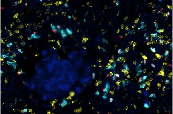 'Cutting the cable' between CD8+ T and T regulatory cells enhances checkpoint immunotherapy