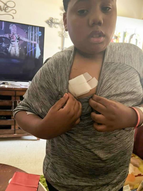 Aderrien Murry shows his wound.
