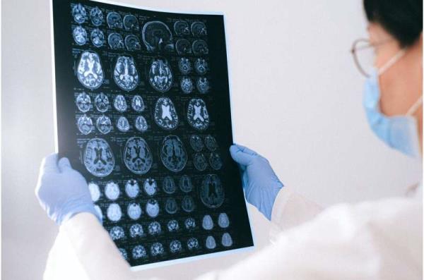 brain MRI