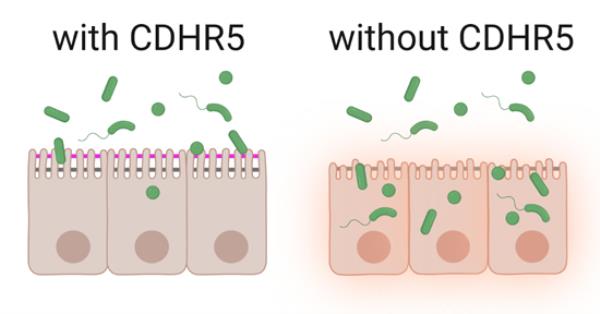 The possible cause of chro<em></em>nic intestinal diseases discovered.  ? Medicine in the Library
