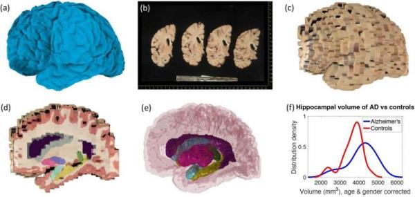 New computer tools can reco<em></em>nstruct 3D brain from biobank photos