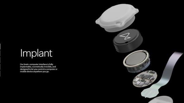 The first human patient has received an implant from brain-chip startup Neural<em></em>ink 